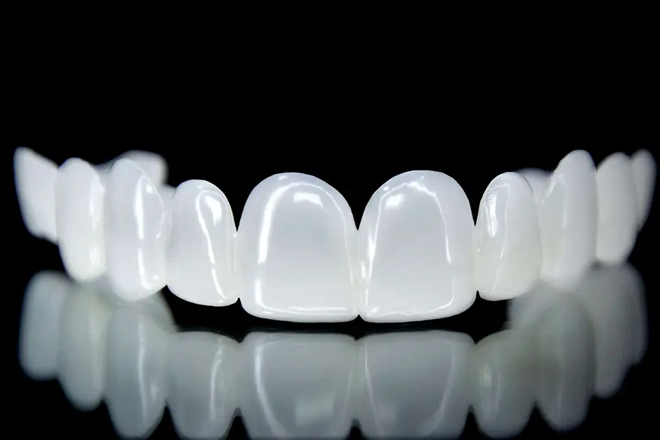 Snap On Veneers for Missing Teeth