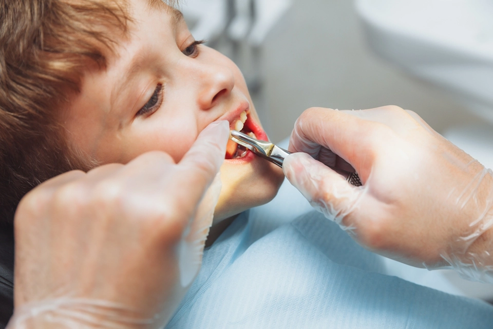 Dental Exam Factors Influencing Root Canal Crown Cost