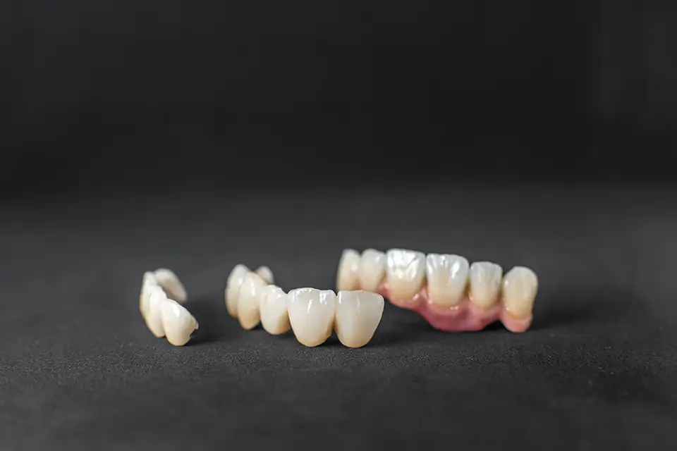 Fixed Dental Bridge: Pros and Cons