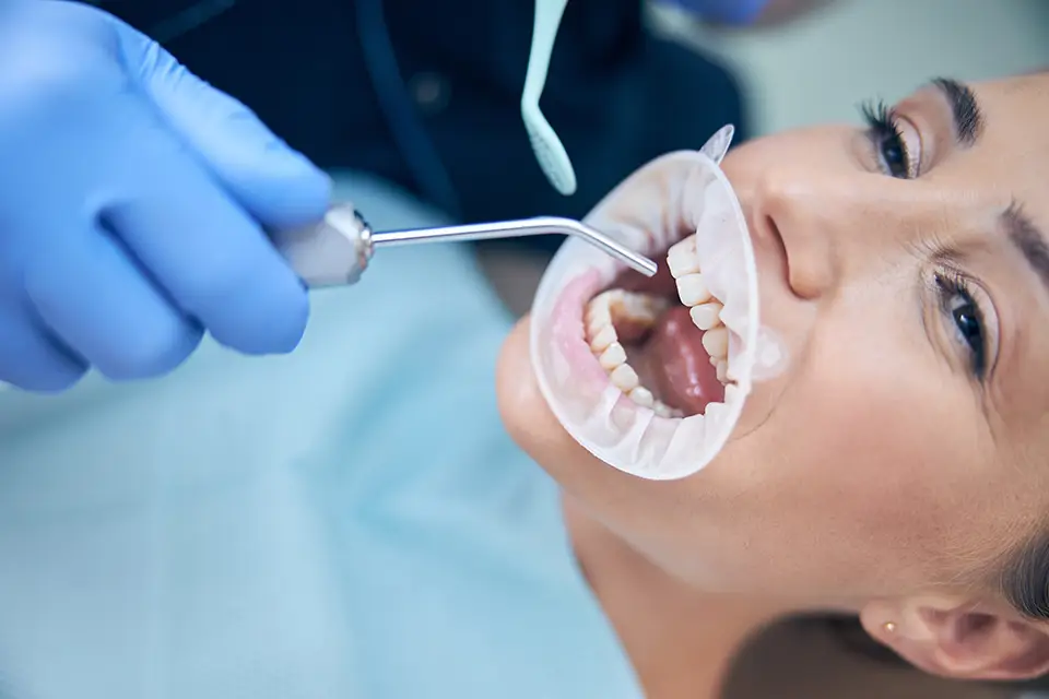Factors Influencing Root Canal Crown Cost
