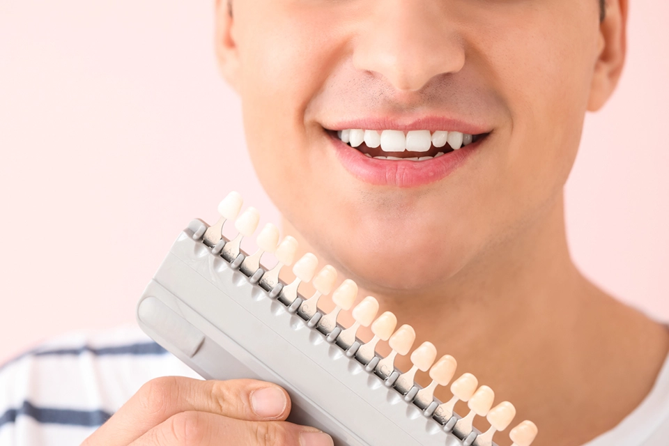 Porcelain Teeth Veneers