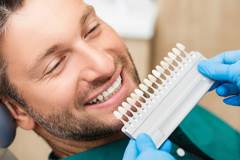 Prepping Teeth for Veneers