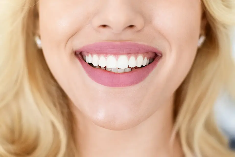 Natural Teeth Whiteners