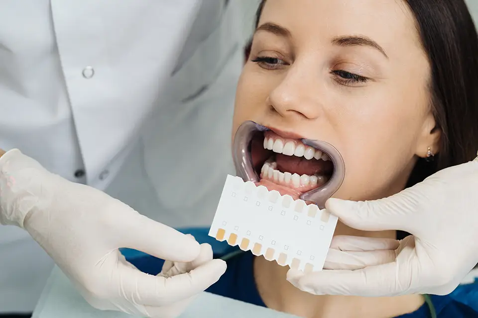 Teeth Lamination
