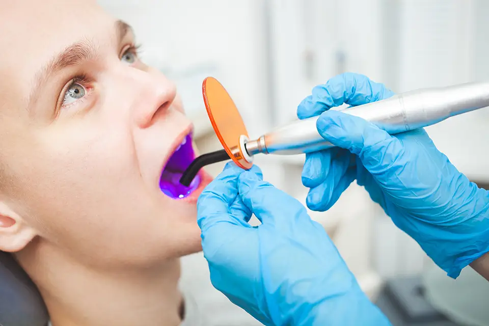 Purple Teeth Whitening