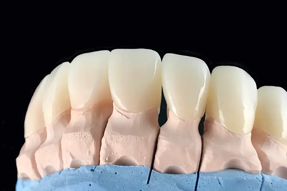 Zirconia Dental Crown