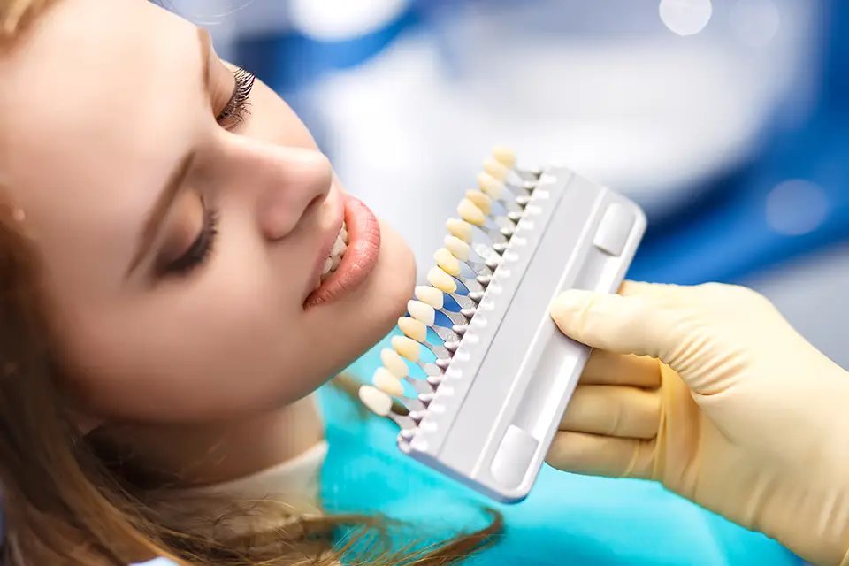 Teeth Bleaching Dentist