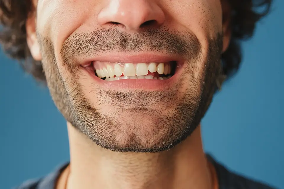 How Can You Replace a Missing Tooth? Top Tooth Replacement Options