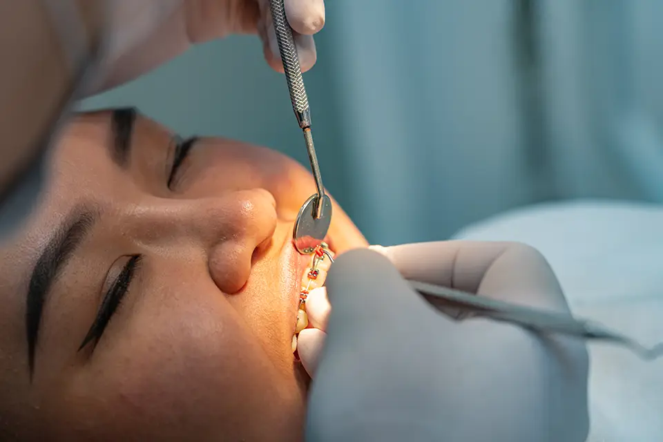 Enamel Microabrasion: When It’s the Right Choice for Whitening Your Teeth