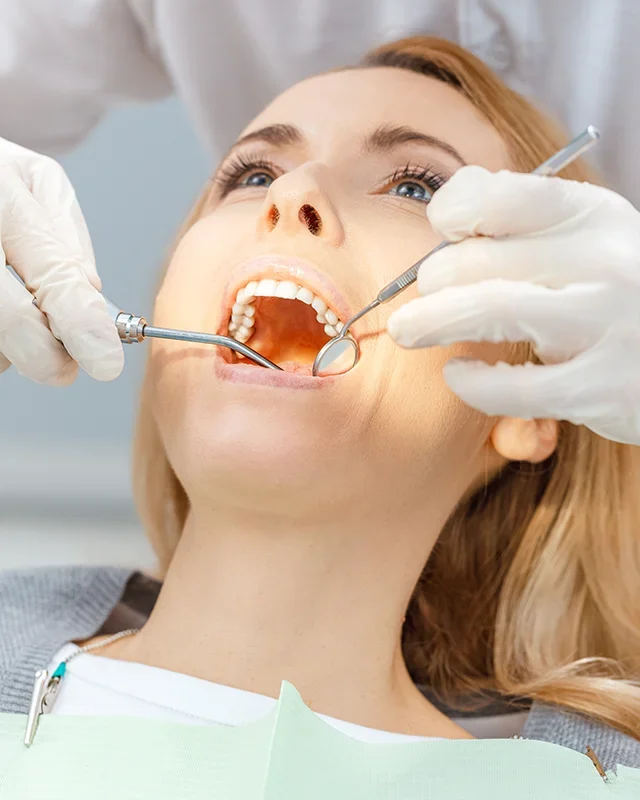 Dental Bonding in Richmond Hill