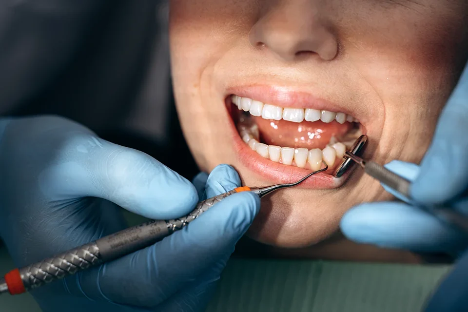 Dental Bridges What Is A Dental Bridge?