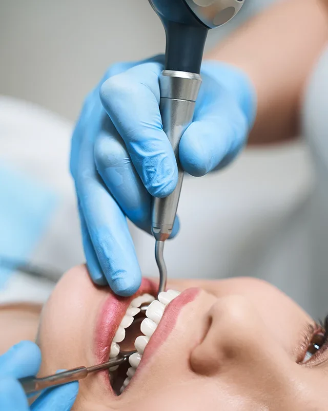 dental implants in Richmond Hill Toronto