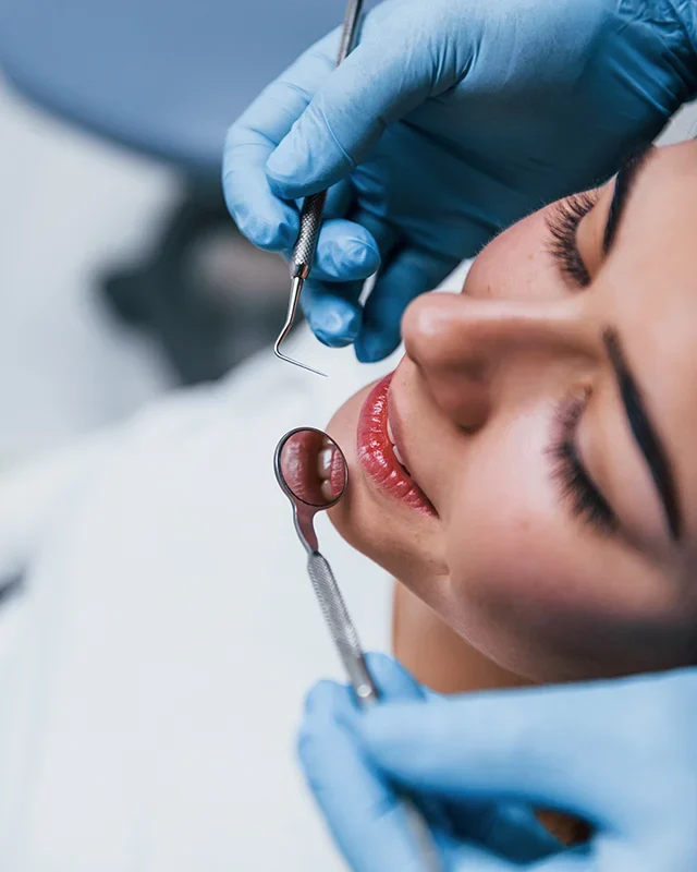 The Benefits of Dental Sealants