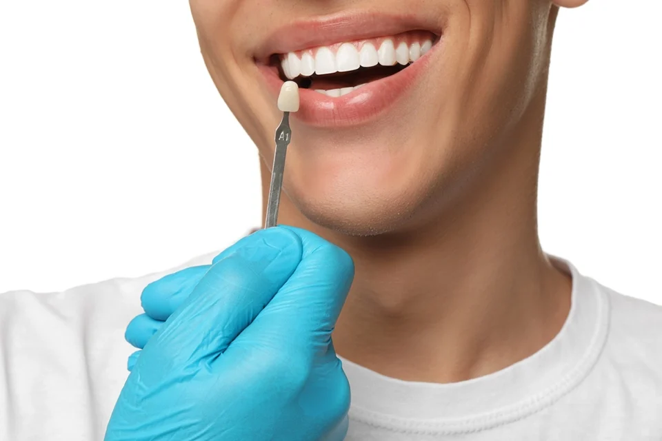 Dental Veneers Why is Shaving Teeth for Veneers Necessary?