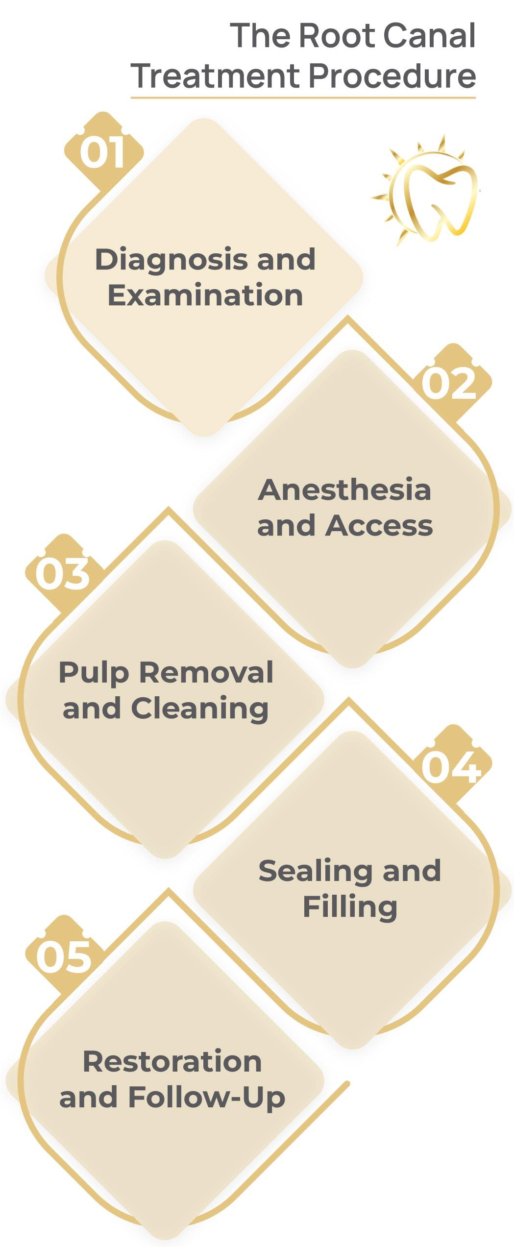 Root Canal Root Canal Treatment Procedure