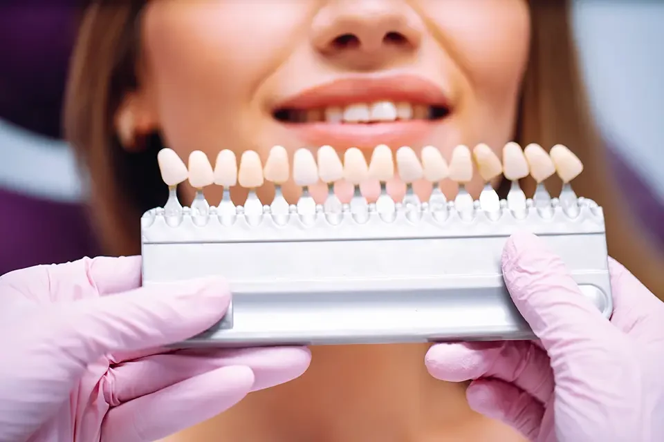 beautiful-woman-smile-with-healthy-teeth-whitening What are Porcelain Teeth Veneers?