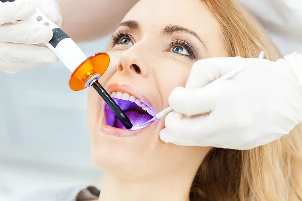 close-up-partial-view-of-dentist How Does Professional Teeth Whitening Work?
