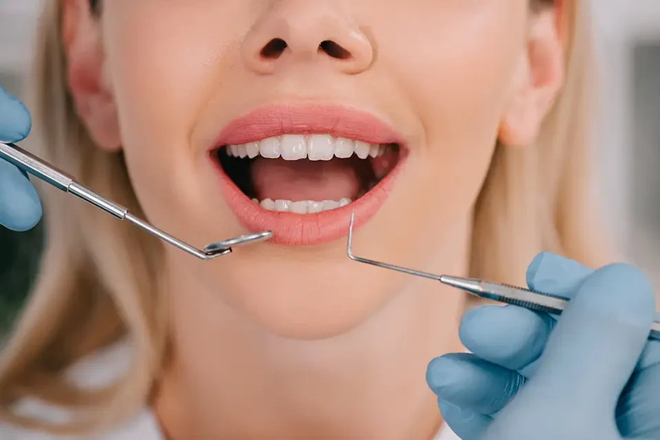 dental exam view Common Causes of Gingivitis