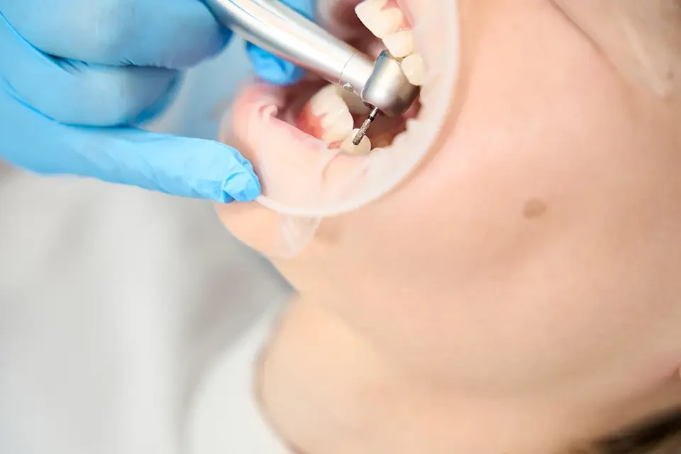 dental examination What Is an Exposed Tooth Root? Understanding the Basics