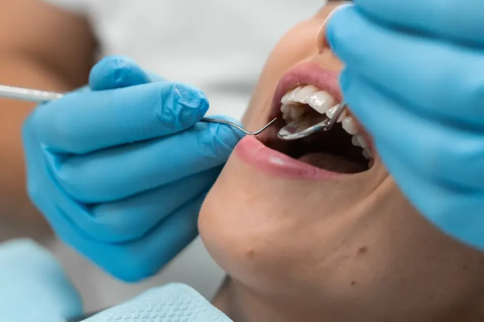 dental examination. Symptoms: How to Tell If Cavities Form on the Sides of Your Teeth