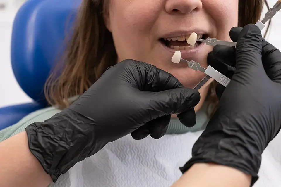 dental treatment How Facial Appearance Changes Over Time with Missing Teeth
