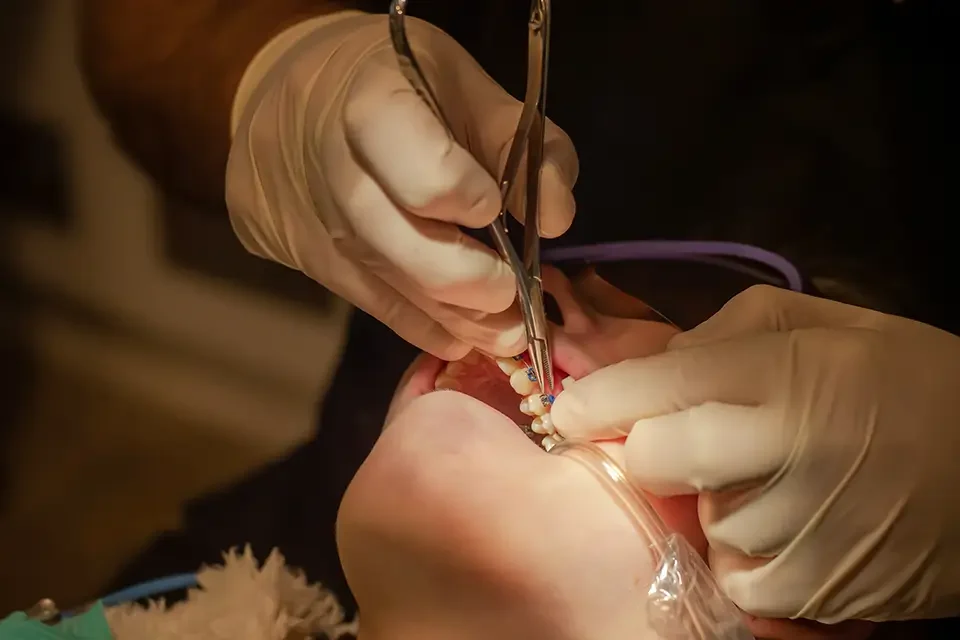 dental treatment process Immediate Relief: How to Manage an Exposed Tooth Root at Home