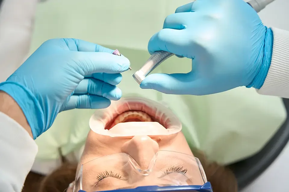 dentist-preparing-to-carry-out-teeth-polishing How is a Dental Composite Filling Procedure Done?