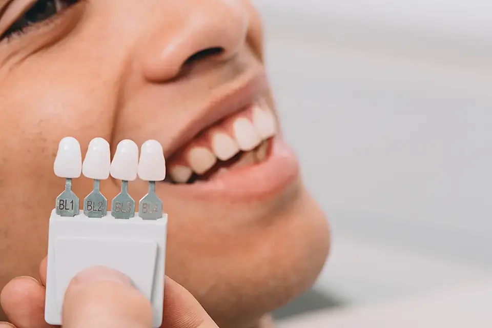 Why Replace Teeth?