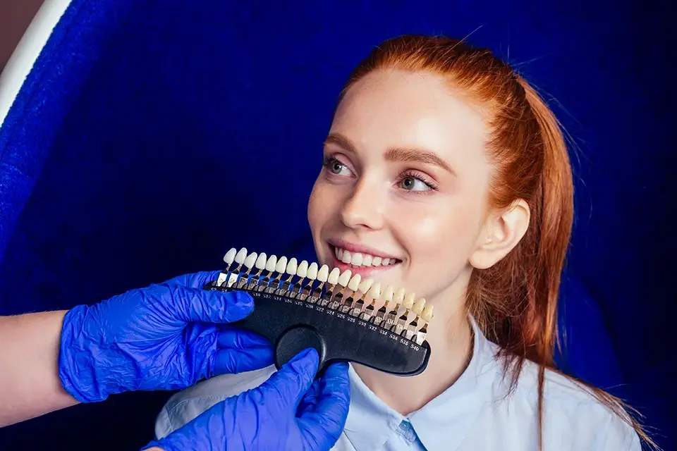 Are You a Candidate for Natural Veneers?