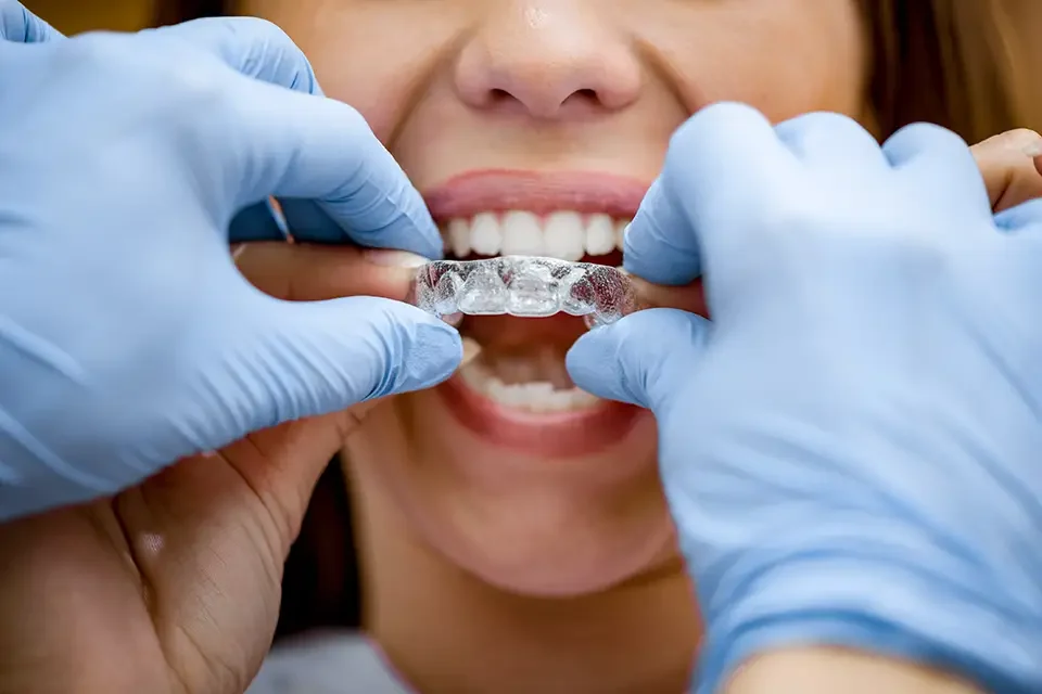 Average Cost of Invisalign Braces in Richmond Hill