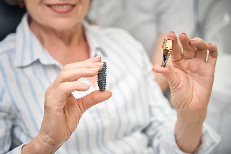 lady-holds-model-of-dental-implant-components Understanding BioHorizons Implants: What Sets Them Apart?