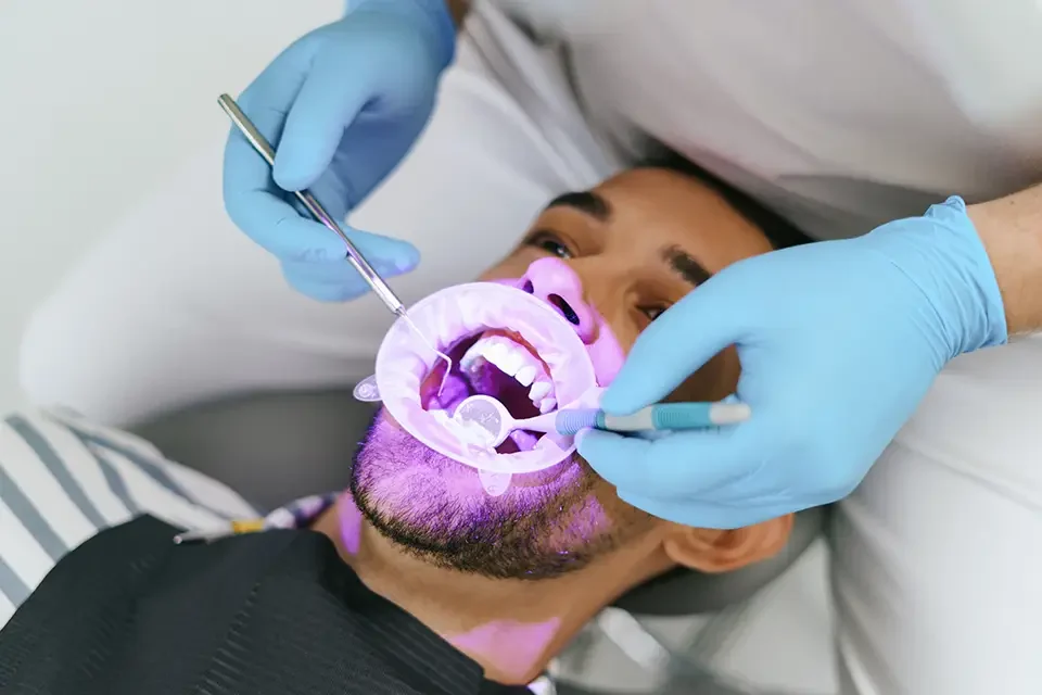 male-dentist-hands-examine-patient How Does Opalescence Whitening Work?