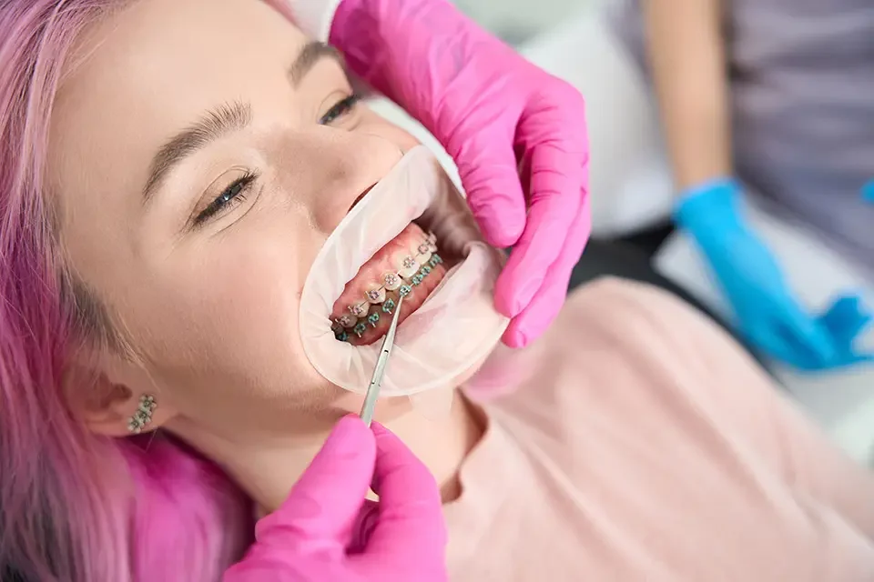 orthodontist-checks-the-system Benefits of Orthodontic Treatments