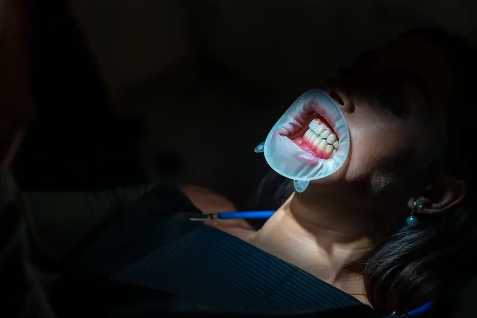 patient-undergoing-teeth-whitening-procedure 7. What Can I Expect After My Deep Teeth Cleaning?