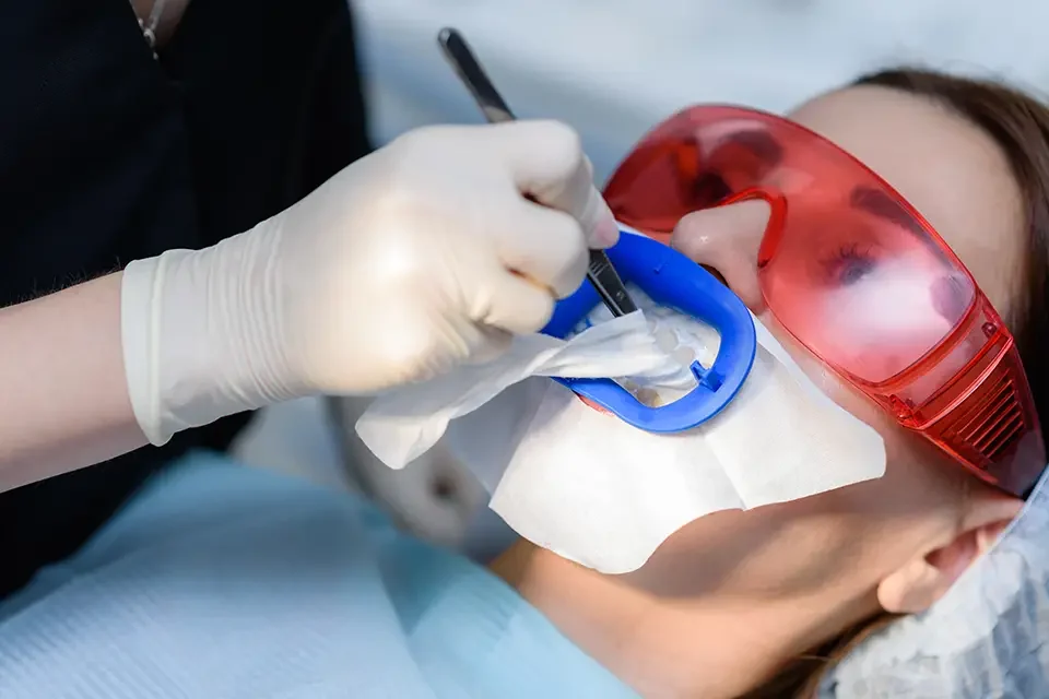 Step-by-Step Dental Sealants Procedure: What Happens at the Dentist