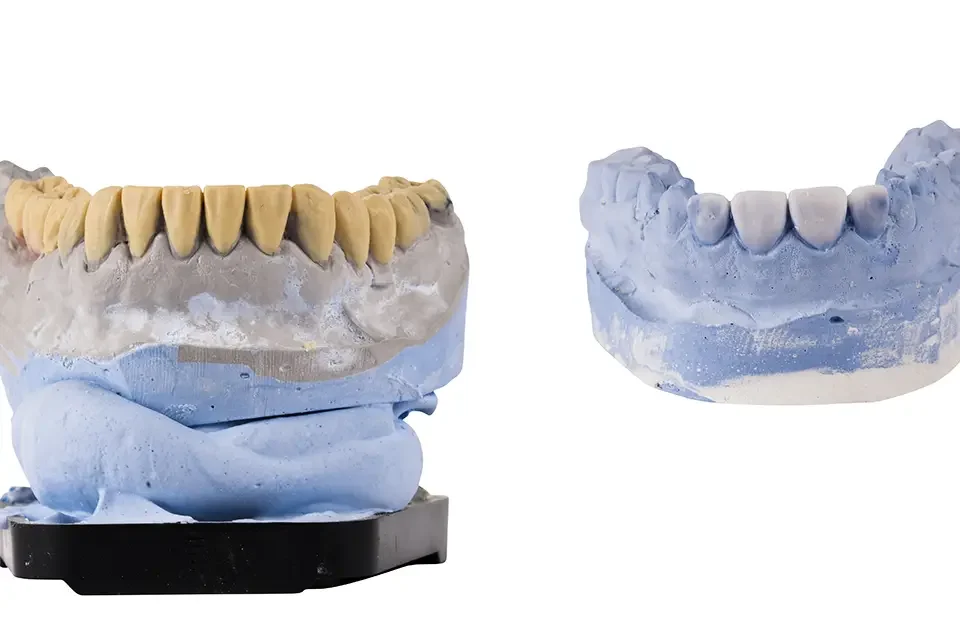 the-jaw-isolated-on-white-background Types of Dental Caps for Teeth