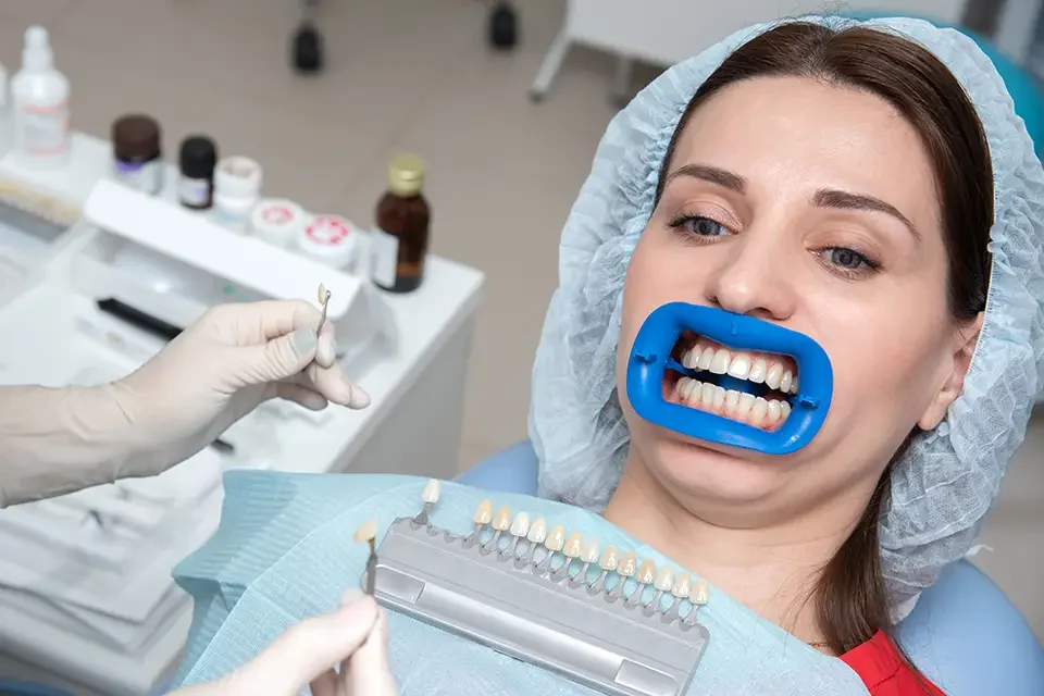 Best Treatment Options When Teeth Whitening Doesn’t Work