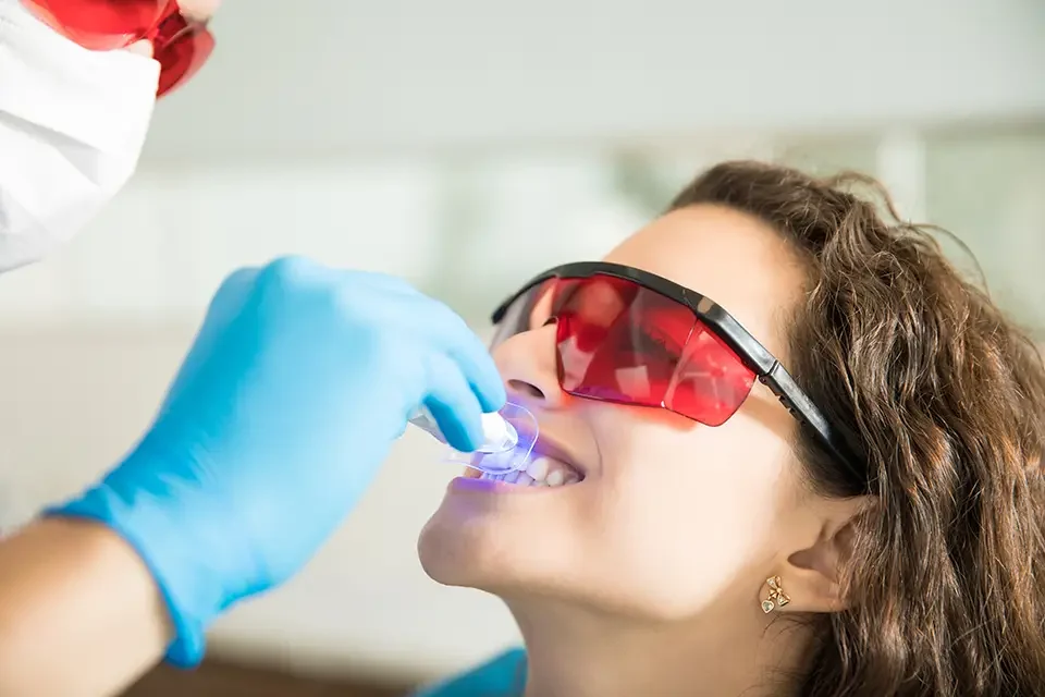 Teeth Whitening for Sensitive Teeth: Why Sensitivity Happens